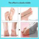 Electric Foot Callus Remover Pink With Replacements Head